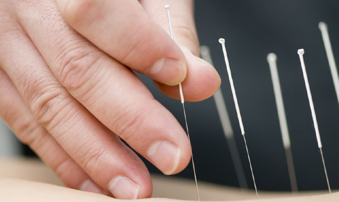 Cosmetic Acupuncture